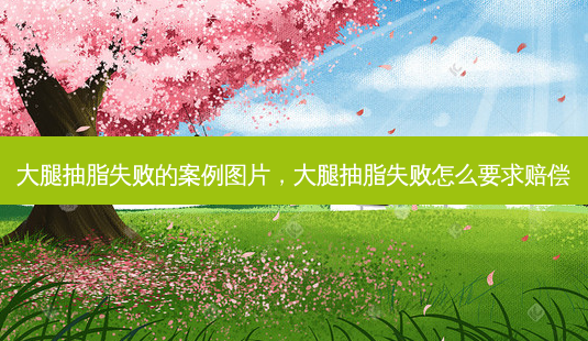 大腿抽脂失败的案例图片,大腿抽脂失败怎么要求赔偿-第1张图片-吾爱整形网 大腿抽脂失败的案例图片,大腿抽脂失败怎么要求赔偿-第1张图片-吾爱整形网