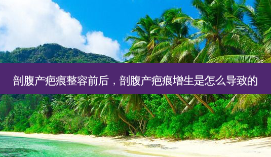 剖腹产疤痕整容前后,剖腹产疤痕增生是怎么导致的-第1张图片-吾爱整形网 剖腹产疤痕整容前后,剖腹产疤痕增生是怎么导致的-第1张图片-吾爱整形网