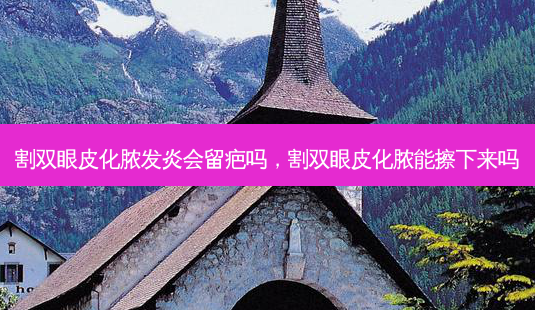 割双眼皮化脓发炎会留疤吗,割双眼皮化脓能擦下来吗-第1张图片-吾爱整形网 割双眼皮化脓发炎会留疤吗,割双眼皮化脓能擦下来吗-第1张图片-吾爱整形网