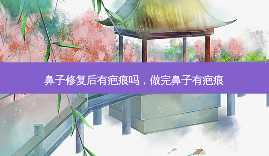 鼻子修复后有疤痕吗,做完鼻子有疤痕-第1张图片-吾爱整形网 鼻子修复后有疤痕吗,做完鼻子有疤痕-第1张图片-吾爱整形网