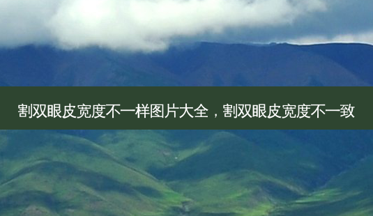 割双眼皮宽度不一样图片大全,割双眼皮宽度不一致-第1张图片-吾爱整形网 割双眼皮宽度不一样图片大全,割双眼皮宽度不一致-第1张图片-吾爱整形网