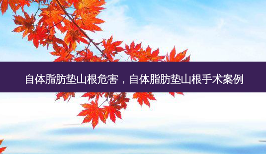 自体脂肪垫山根危害,自体脂肪垫山根手术案例-第1张图片-吾爱整形网 自体脂肪垫山根危害,自体脂肪垫山根手术案例-第1张图片-吾爱整形网