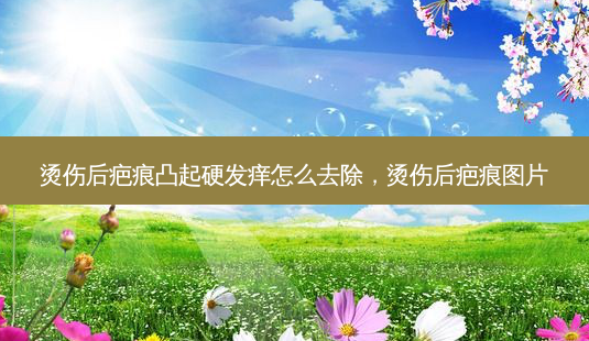 烫伤后疤痕凸起硬发痒怎么去除,烫伤后疤痕图片-第1张图片-吾爱整形网 烫伤后疤痕凸起硬发痒怎么去除,烫伤后疤痕图片-第1张图片-吾爱整形网