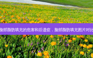 脸部脂肪填充的危害和后遗症，脸部脂肪填充图片对比