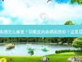 双眼皮肉条感怎么修复？双眼皮肉条感困扰你？这里是修复方法