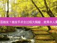 什么是植发？植发手术全过程大揭秘，效果令人震惊！