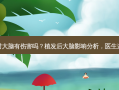 植发对大脑有伤害吗？植发后大脑影响分析，医生这样说