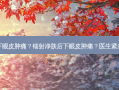 做完镭射净肤后下眼皮肿痛？镭射净肤后下眼皮肿痛？医生紧急提醒恢复期细节
